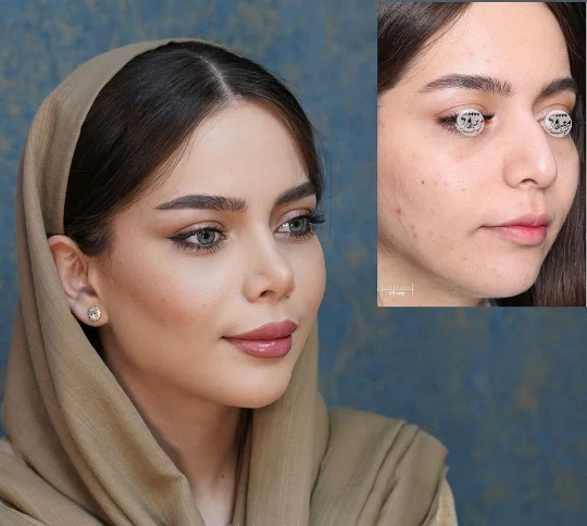 محفظة جراحة التجميل