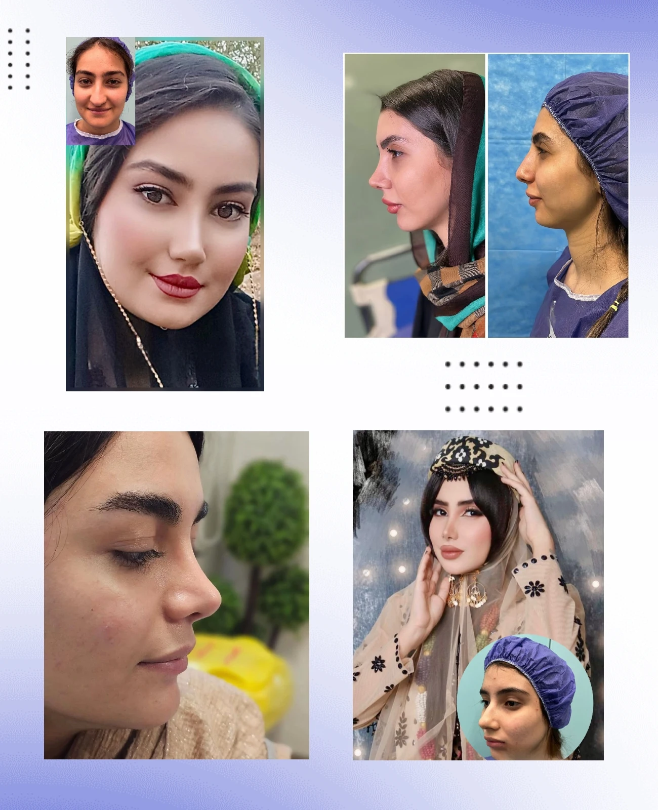 صور قبل وبعد الدكتور مراد کتیرائی