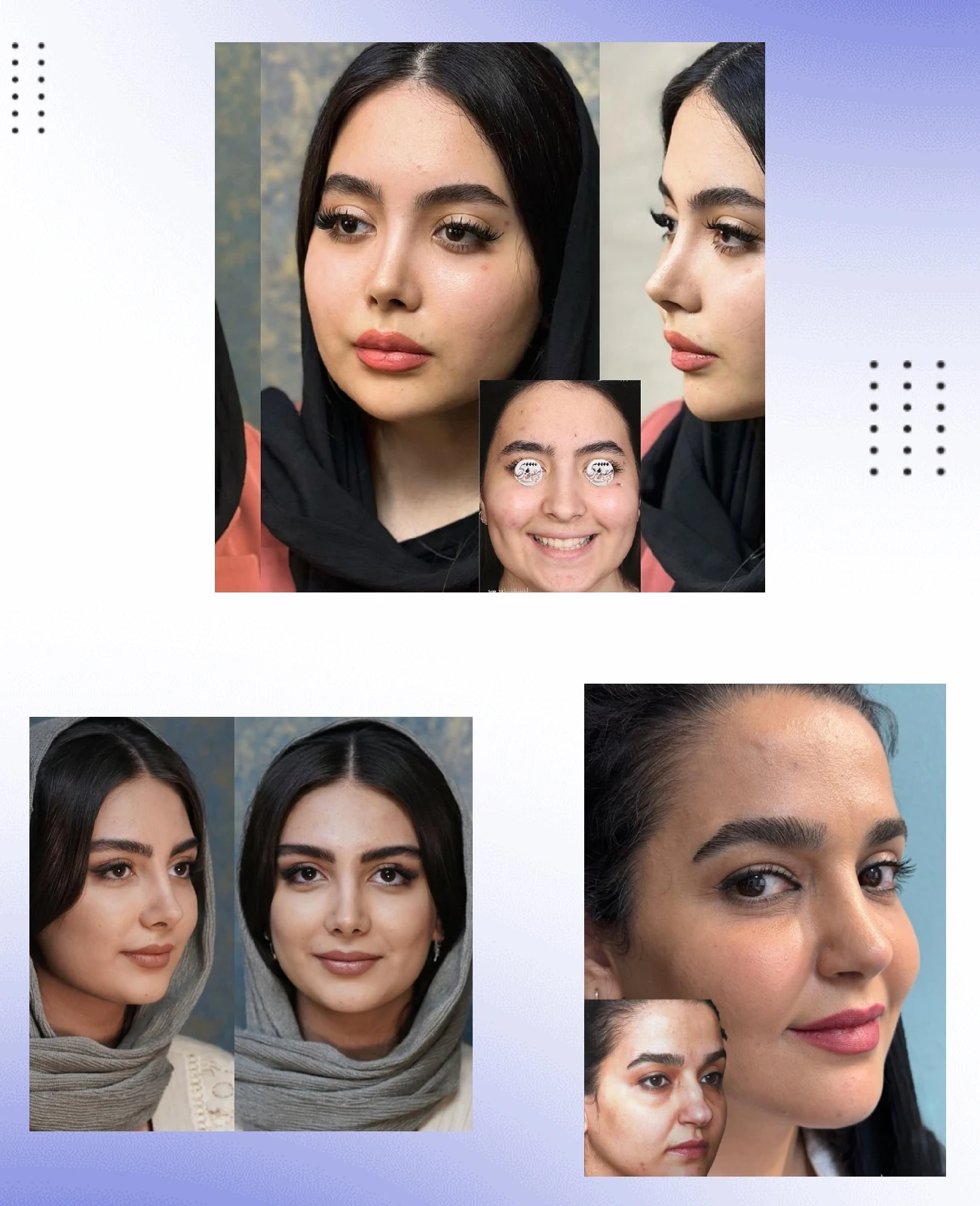 صور قبل وبعد الدكتور بابك معتقدي