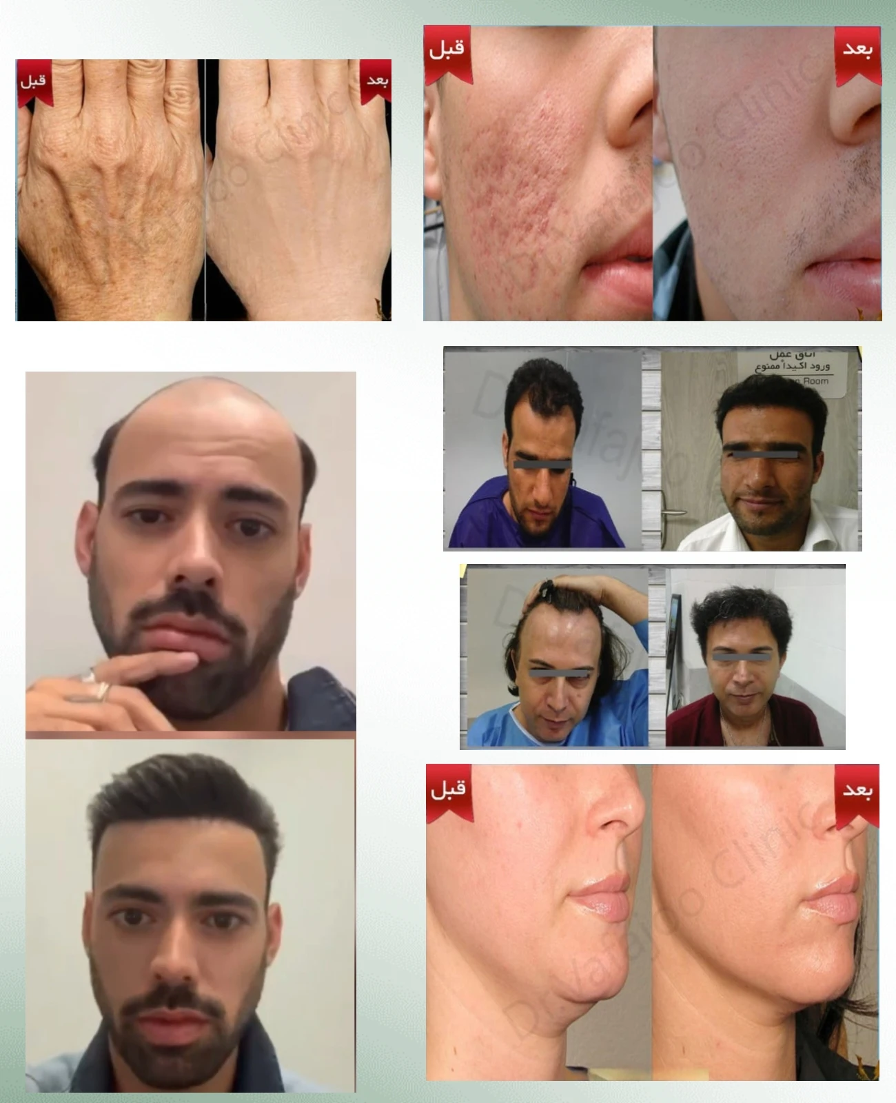 الدكتورة شهلا وفاجو صور قبل وبعد