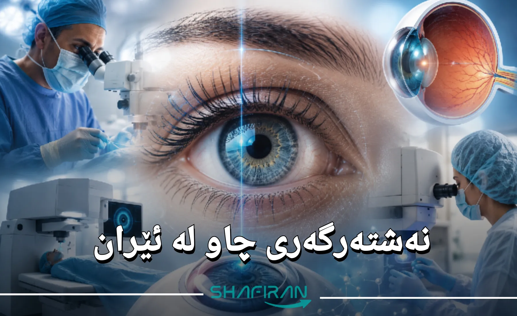 نەشتەرگەری چاو لە ئێران