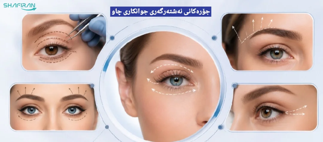 نەشتەرگەری جوانکاری چاو لە ئێران