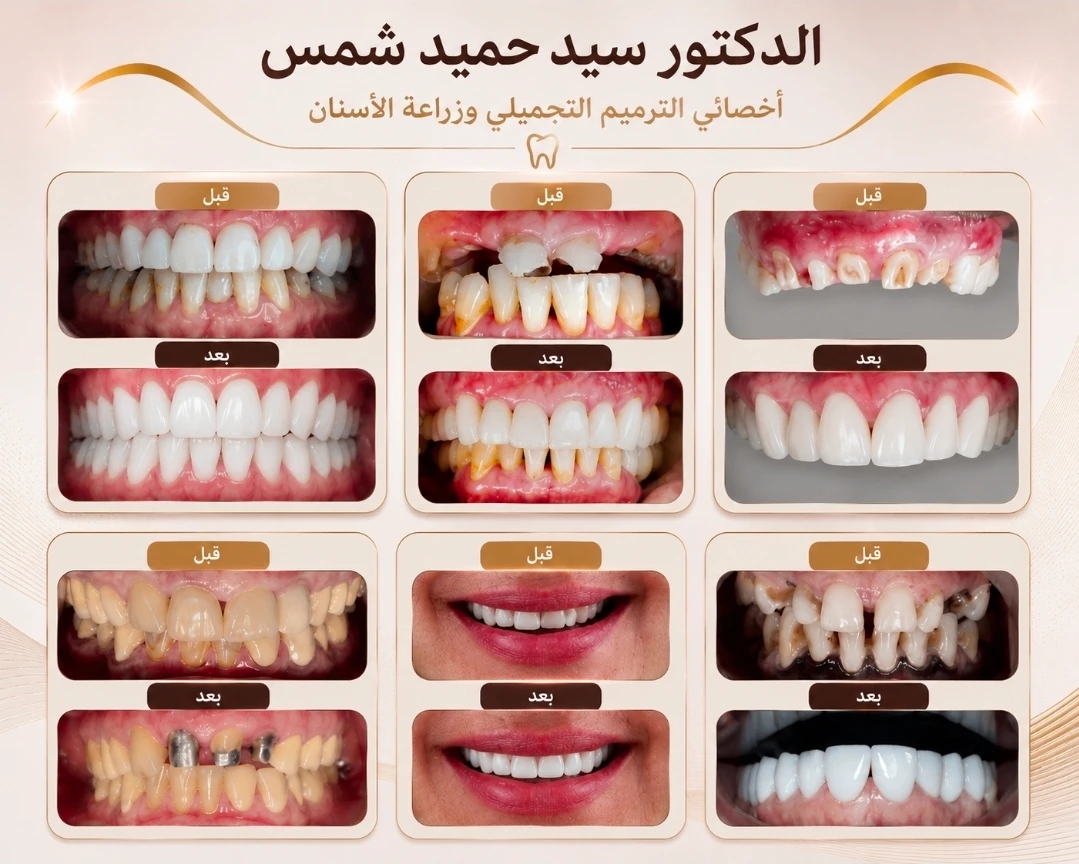 حالة قبل وبعد من أعمال دكتور حميد شمس