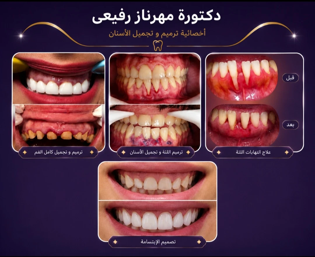 حالة قبل وبعد من أعمال دكتورة مهرناز رفيعي