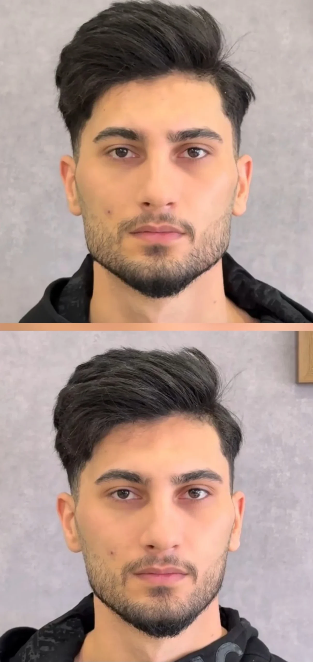 زاوية فك الرجل