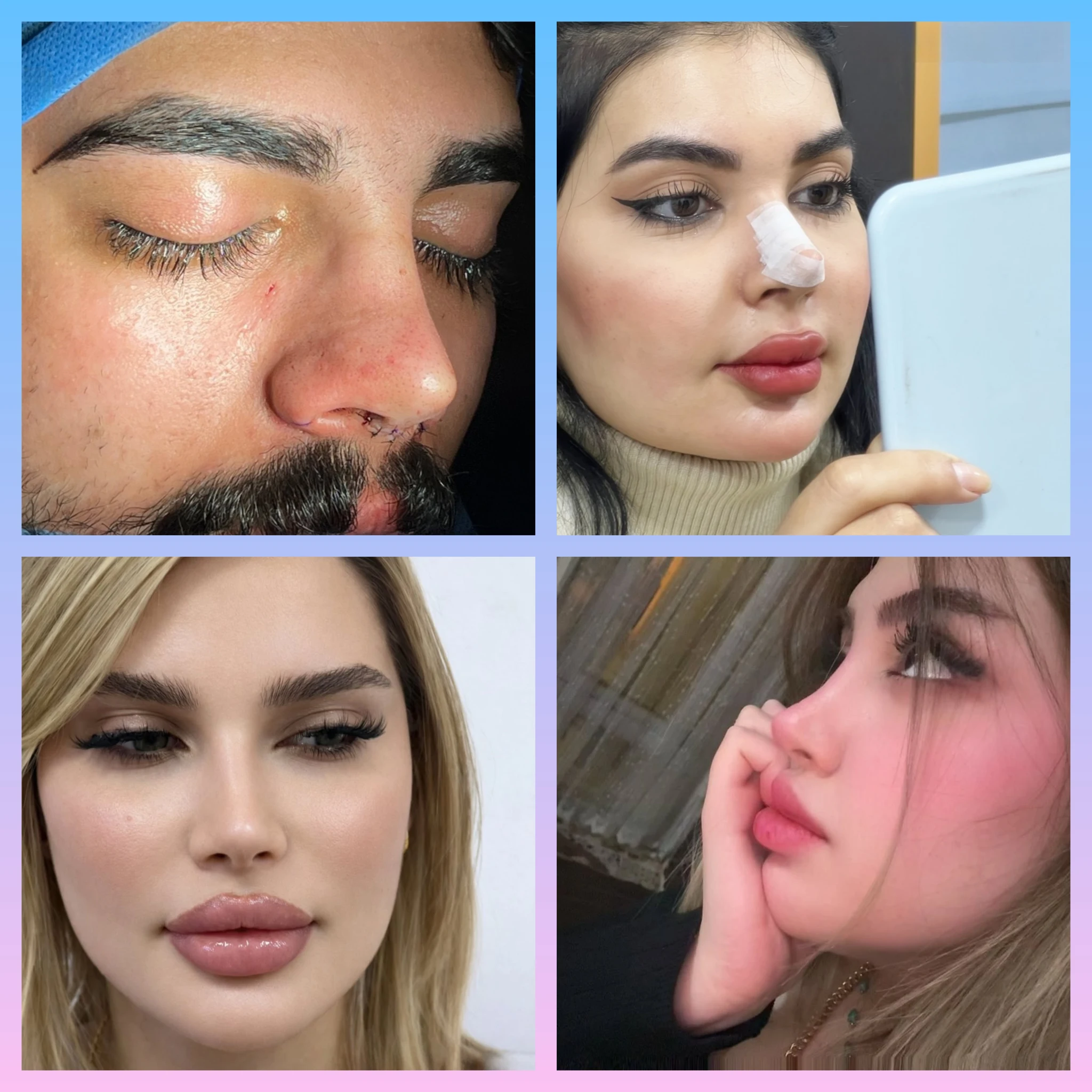 صور قبل وبعد دكتور عادل عمار
